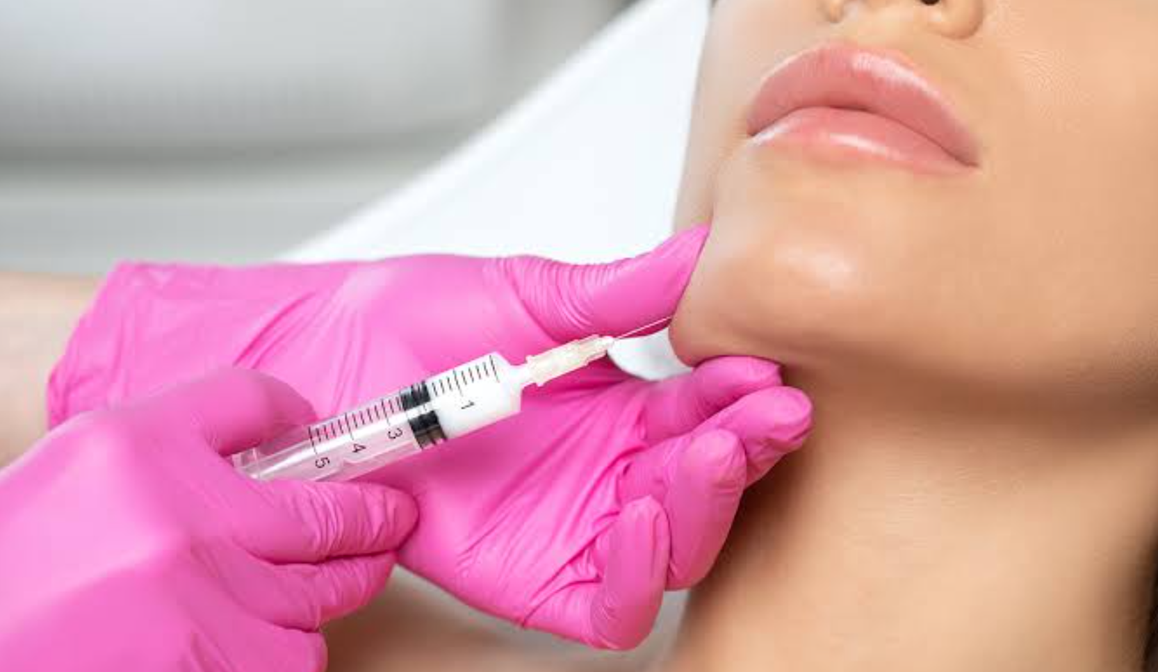 Facial Fat Grafting: What Modern Patients Should Consider